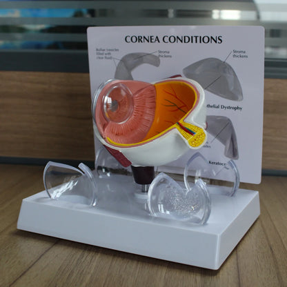 Human Eye Anatomy Model - in use