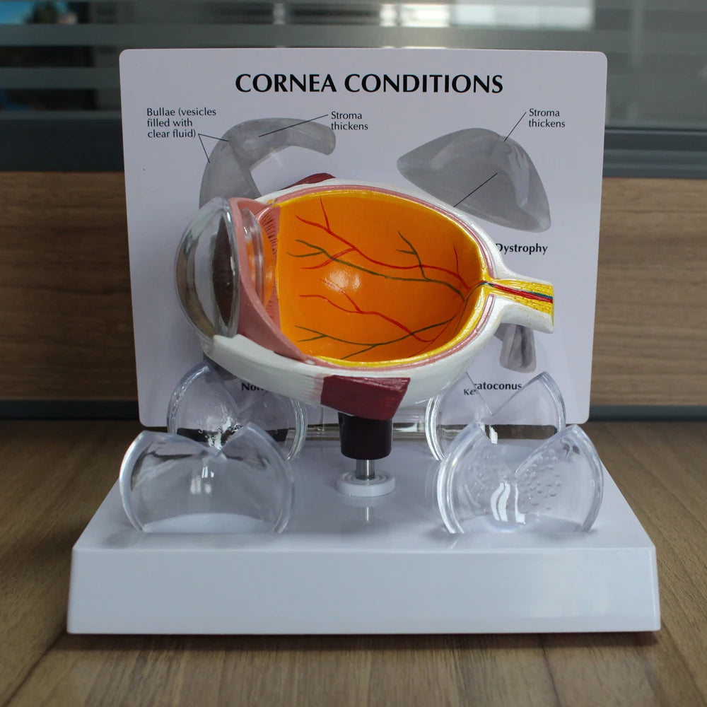 Human Eye Anatomy Model - close-up of details