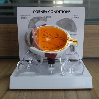 Human Eye Anatomy Model - close-up of details