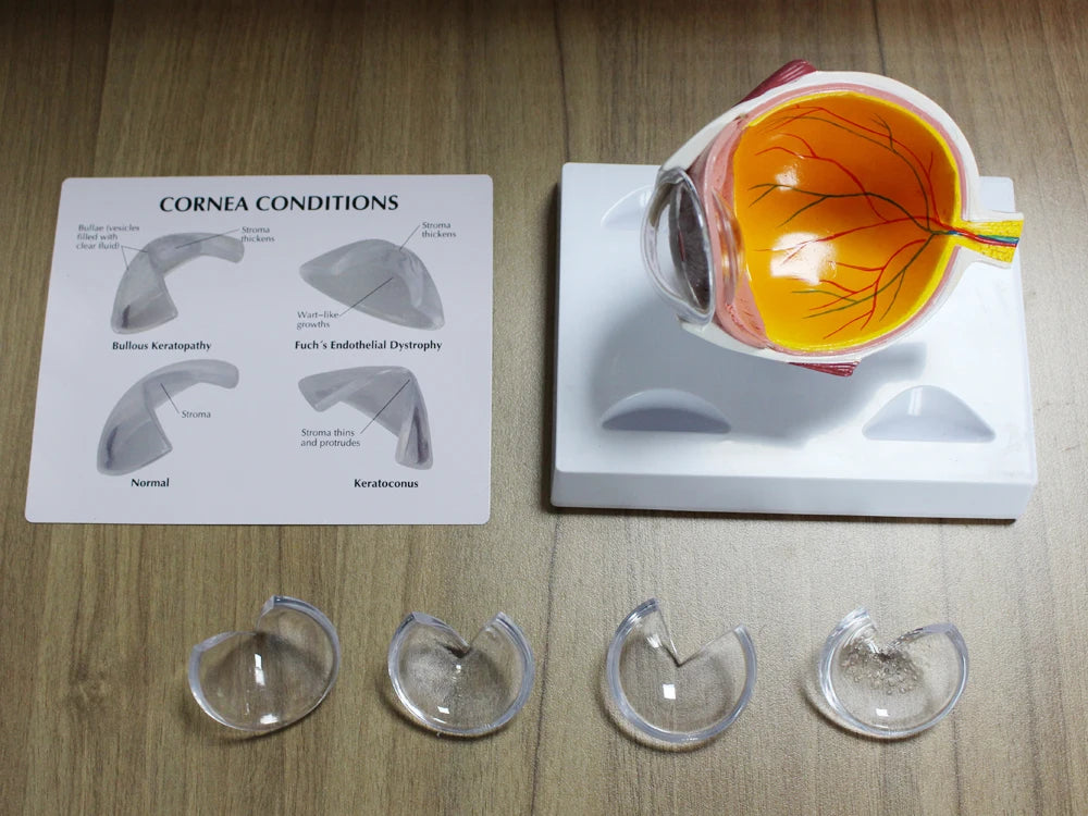 Human Eye Anatomy Model - side view