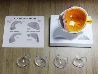 Human Eye Anatomy Model - side view