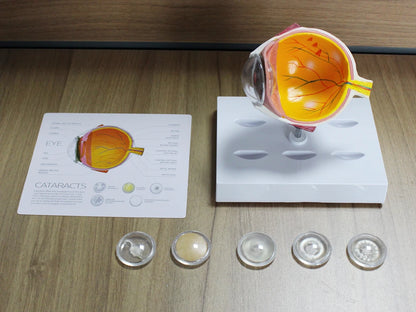 Human Eye Anatomy Model - additional view 10