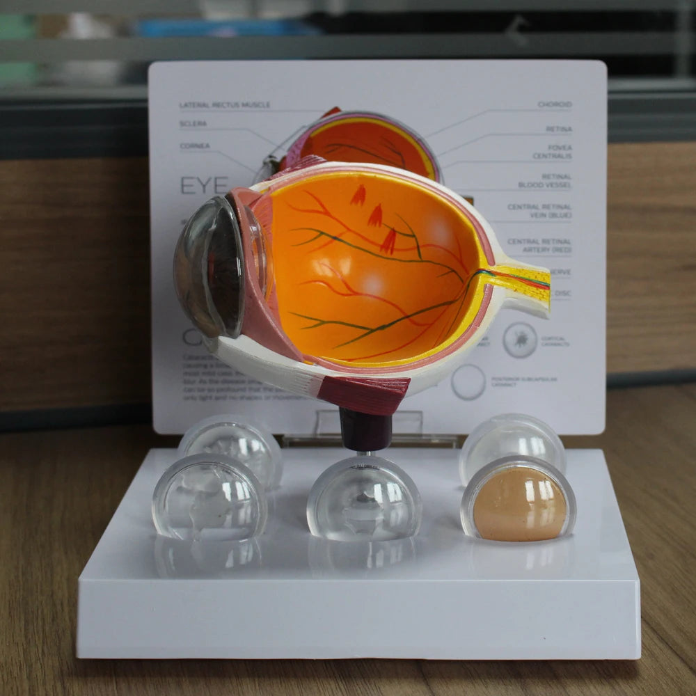 Human Eye Anatomy Model - what's included